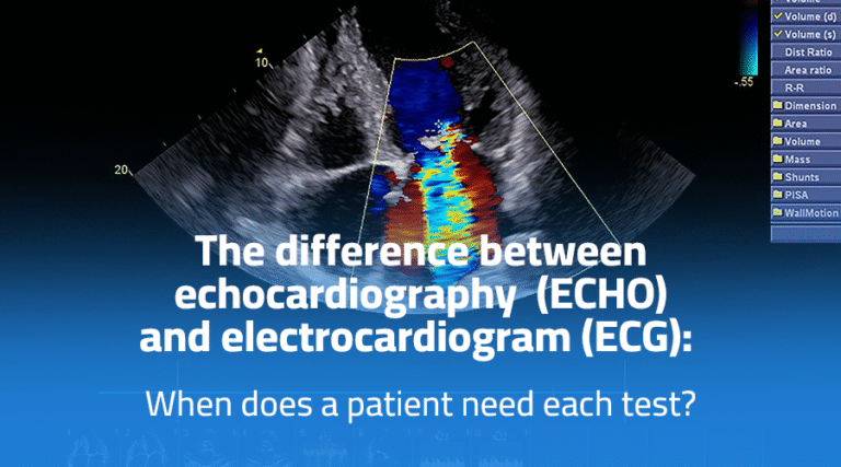 Difference Between ECHO and ECG: When Does a Patient Need Each Test ...